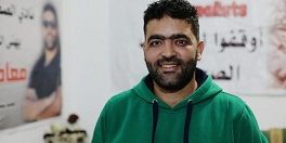 Amarneh now has a temporary cosmetic eye-shaped lens