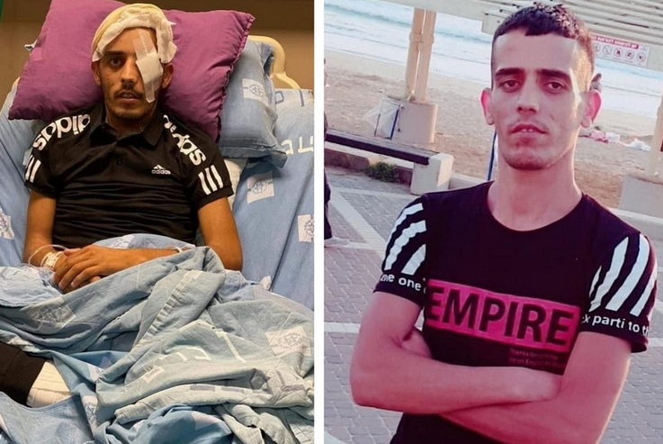 Palestinian dies of injuries he sustained two years ago