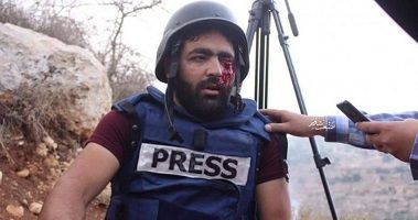 Palestinian journalist loses eye to Israeli bullet