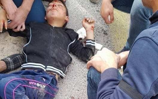 Settler�s hit and run injures 9-year-old Palestinian child in Bethlehem