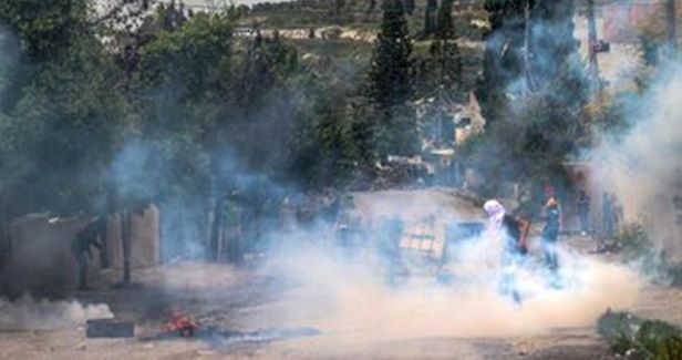 79 Palestinians injured in Burqa clashes
