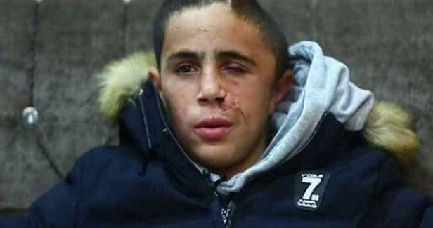 Palestinian kid forced to say he was not injured by Israeli gunfire