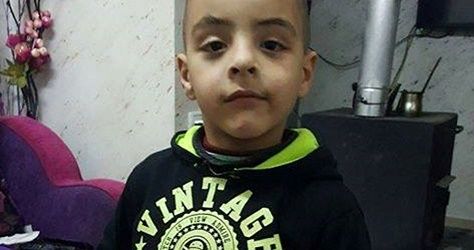 Palestinian child hit with teargas canister in the head
