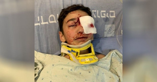 IOF injures child, arrests citizens in Jerusalem and West Bank