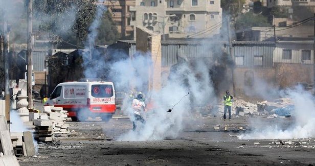 Palestinian young man injured by IOF bullets in Jenin