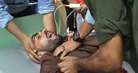 Calls on WHO to intervene against force-feeding prisoners