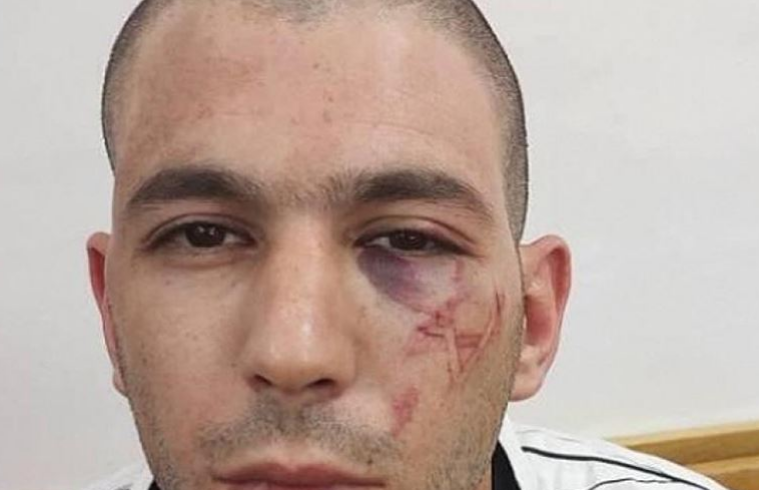 Israeli police brand Palestinian detainee with Star of David