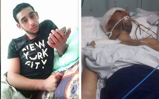 Gazan young man dies of injury sustained last month