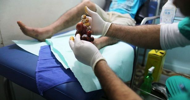 Turkey to provide $1.2 million to Palestinians in Gaza