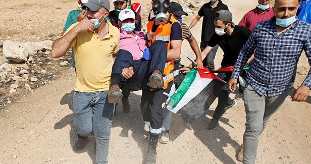 Dozens injured in Nablus weekly marches