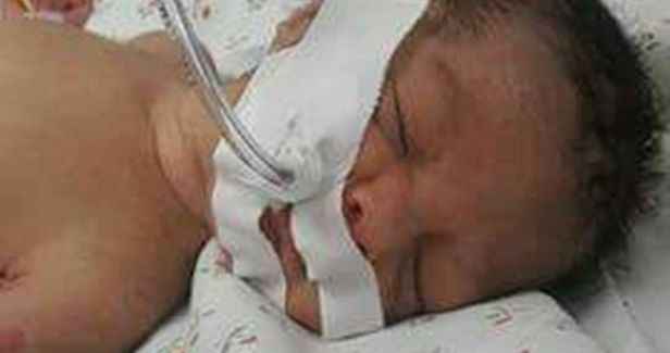 Gaza: Baby girl dies due to lack of respiratory drug