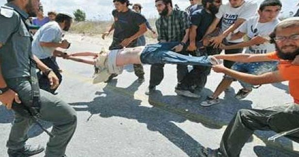 Palestinian seriously wounded by Jewish fanatics in Haifa