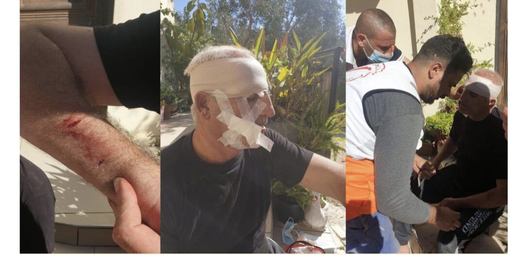 21 Palestinians injured in Israeli settlers’ attack on Nablus-area village