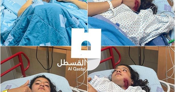 Dozens injured, arrested in Israeli police violence in holy city