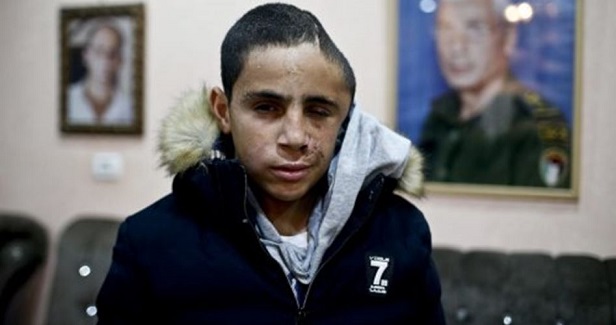 IOF arrests Palestinian injured child