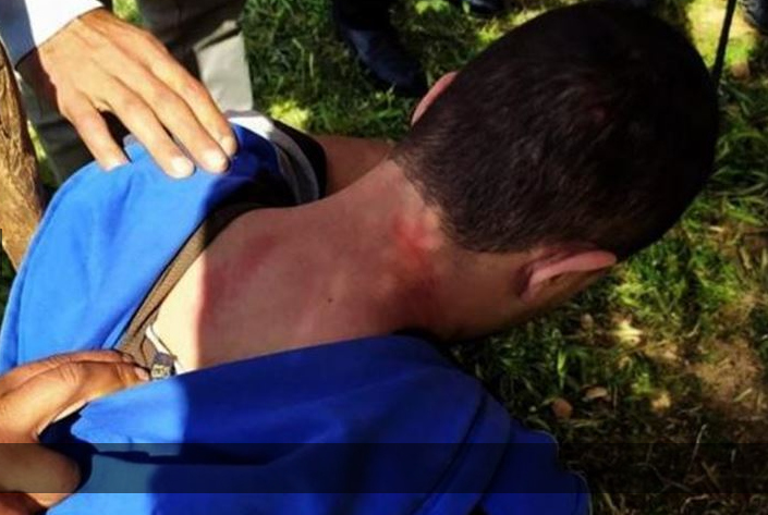 Palestinian injured in settler attack