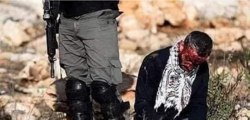 Palestinian succumbs to IOF-inflicted wounds