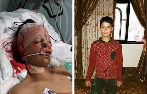 Child succumbs to his wounds to be Gaza's 46th martyr