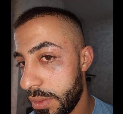 Israeli forces carry out assaults, detentions, raids in East Jerusalem