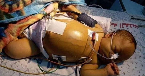 Gazan infant dies after being denied treatment by Ramallah