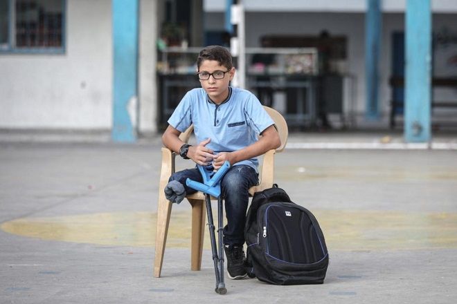 WHO: 3 children a month in Gaza left disabled for life