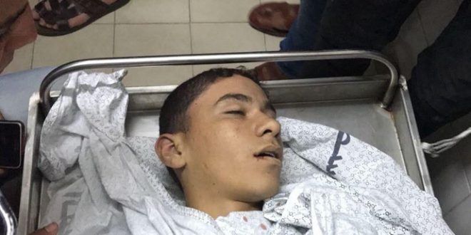 One Palestinian boy killed, 395 others injured by IOF in Gaza borderac