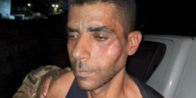 Freedom fighter Zakaria Zubeidi hospitalized due to acute beating by Israeli police