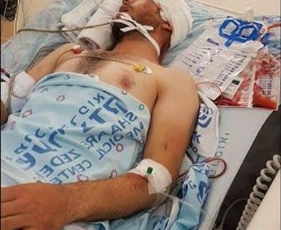 Palestinian critically injured in hit-and-run by Israeli settler
