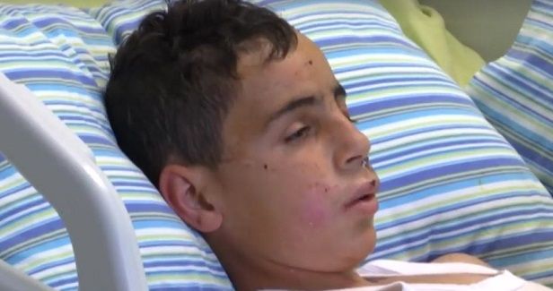 A child with an IOF bullet in his skull