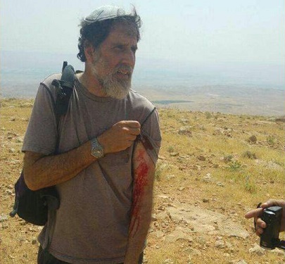 Settlers assault Israeli pro-Palestine activist