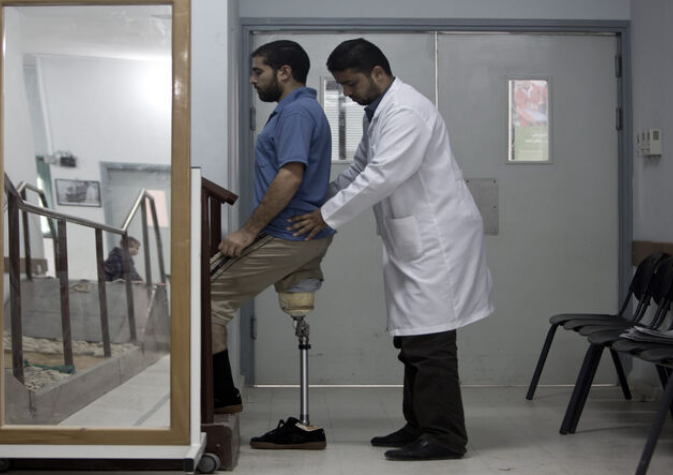 Amputee receives first smart prosthetic limb in Gaza