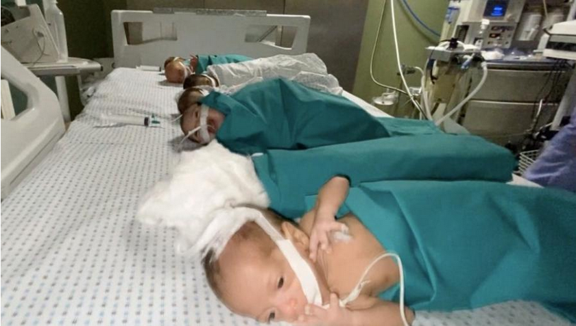 Infants in northern Gaza at dangerous stage due to drought and malnutrition