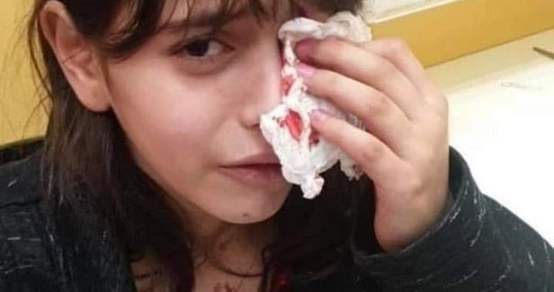 Jerusalemite child injured after settler attack her in Old City