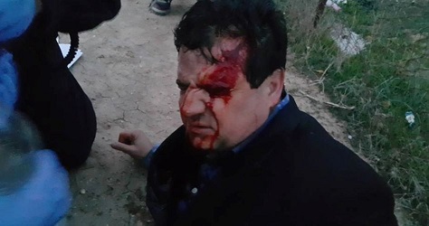 Join list slams police violence in the village ...Two Arab MKs injured by Israeli police in Umm al-Hiran events