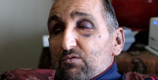 Israeli occupation soldiers mercilessly beat up disabled Palestinian man in his bed