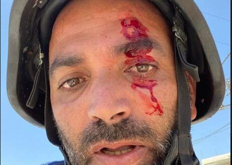 MADA: 43 violations against media freedoms in Palestine during July