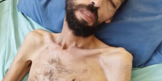 After six months of hunger strike, administrative detainee Awawda says he is left with bone and skin only