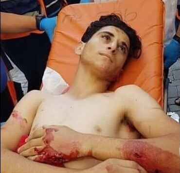 Israel extends detention of injured Palestinian prisoner