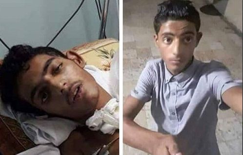 Child injured in March of Return succumbs to his wounds