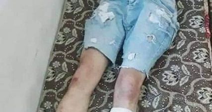 Israeli forces beat, injure Palestinian worker