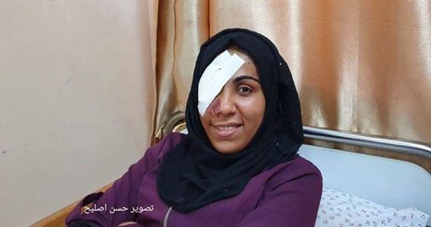Mai: Latest but not first girl to lose her eye by Israeli bullet