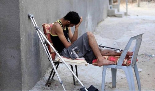 نقص 80% من أدوات الجراحة يهدد آلاف الجرحى ببتر الأعضاء أو الموت