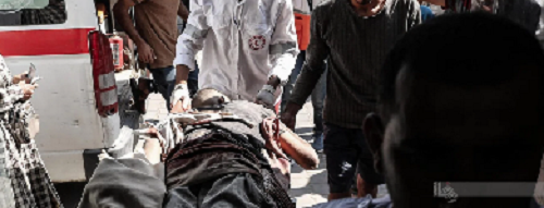 شهيدان بينهما طفل وإصابات جديدة برصاص وقصف الاحتلال في قطاع غزة