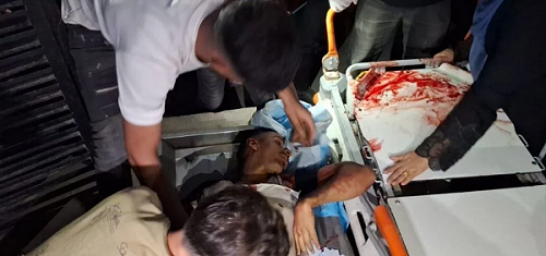 شهيدان ومصابون بقصف وإطلاق نار للاحتلال في غزة ودير البلح